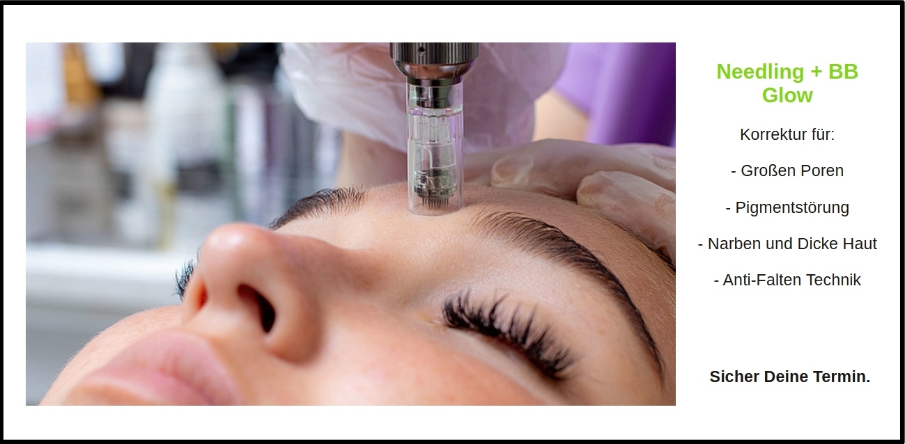 25 – Header Inlights – Needling