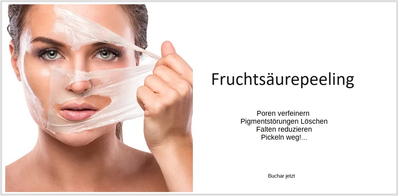 26 – Header Inlights – Saurepeeling