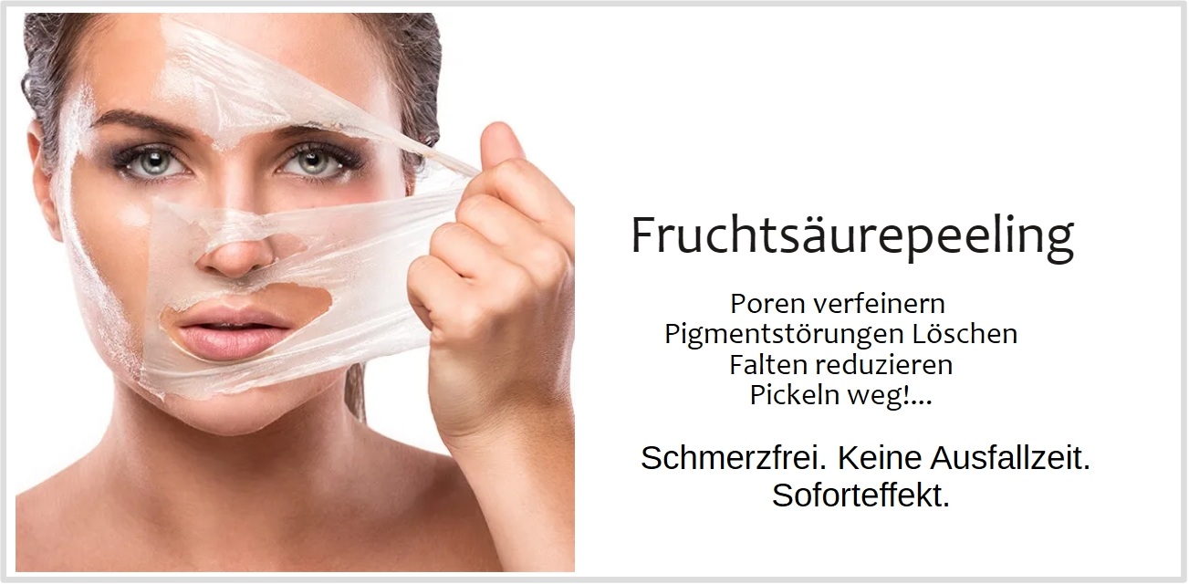 26 – Header Inlights – Saure